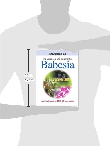 The Diagnosis and Treatment of Babesia