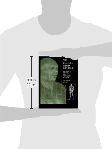 The Visible Human Project