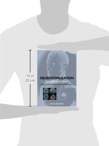 Neurostimulation: Principles and Practice
