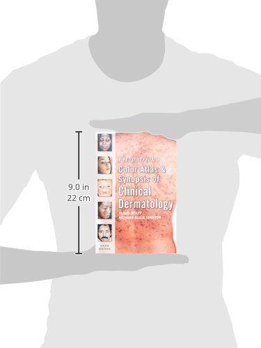 Fitzpatrick's Color Atlas and Synopsis of Clinical Dermatology: Sixth Edition