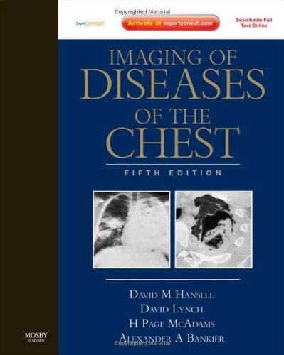 Imaging of Diseases of the Chest: Expert Consult - Online an