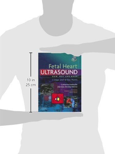 Fetal Heart Ultrasound: How, Why and When by Fredouille MD,
