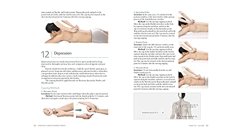 Practical Guide to Cupping Therapy: A Natural Approach to Heal Through Traditional Chinese Medicine