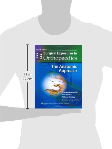Surgical Exposures in Orthopaedics: The Anatomic Approach (H