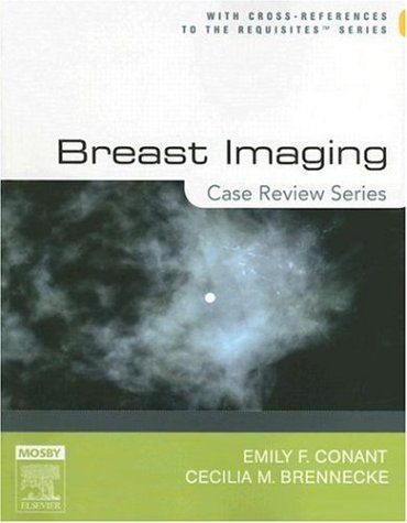 Breast Imaging: Case Review Series by Emily Conant
