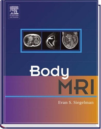 Body MRI
