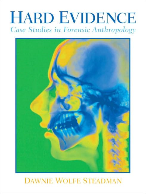 Hard Evidence: Case Studies in Forensic Anthropology
