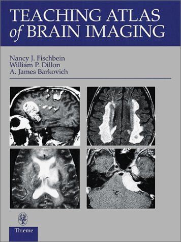Teaching Atlas of Brain Imaging (Teaching Atlas Series)