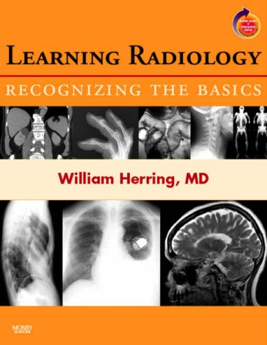 Learning Radiology: Recognizing the Basics (With STUDENT CON