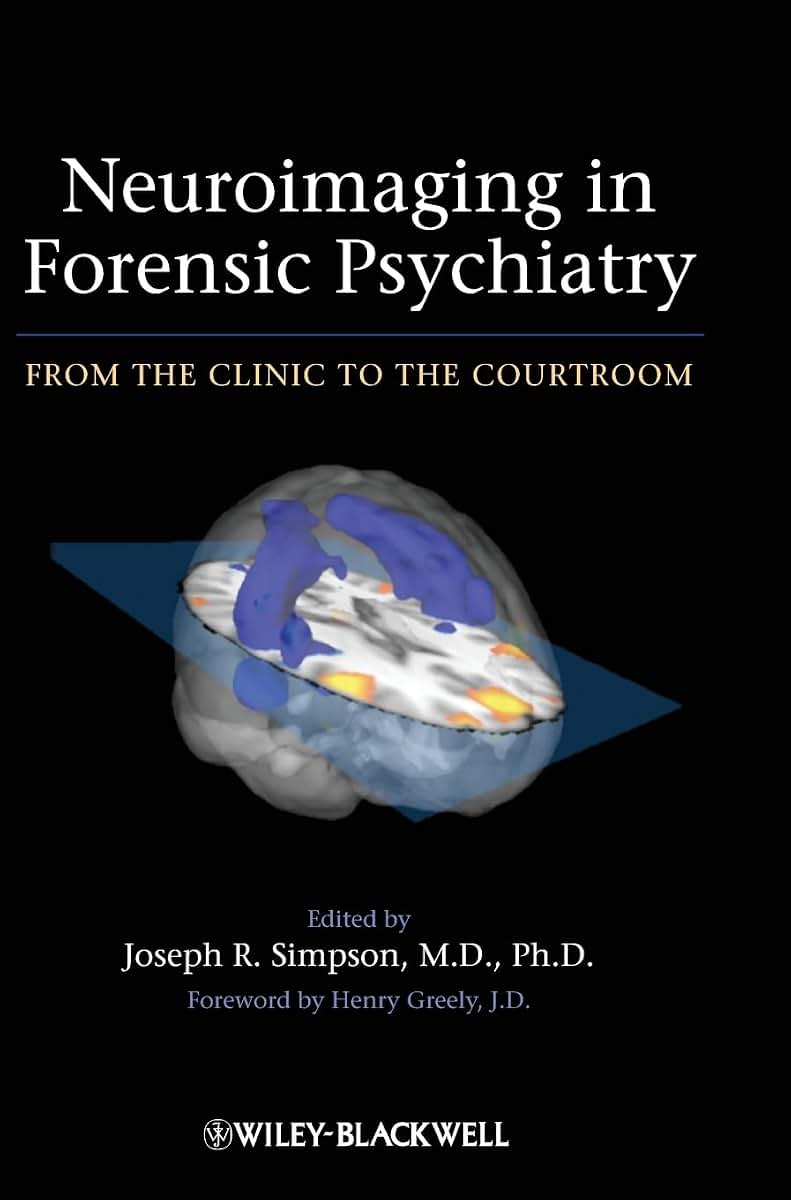 Neuroimaging in Forensic Psychiatry: From the Clinic to the Courtroom