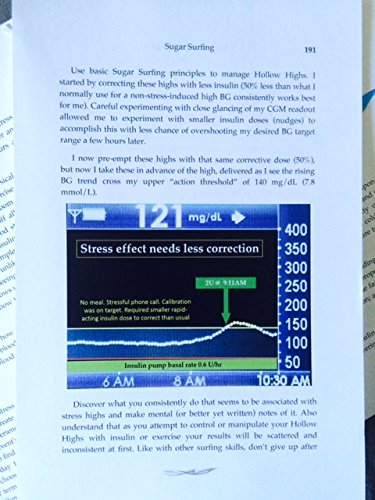 Sugar Surfing: How to Manage Type 1 Diabetes in a Modern World