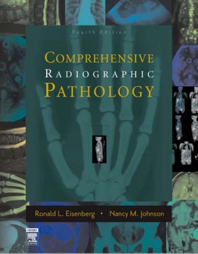 Comprehensive Radiographic Pathology by Eisenberg MD JD FACR