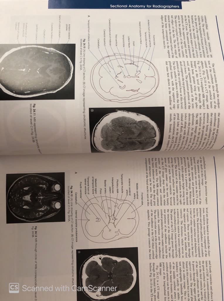 Merrill's Atlas of Radiographic Positioning and Procedures - Volume 3