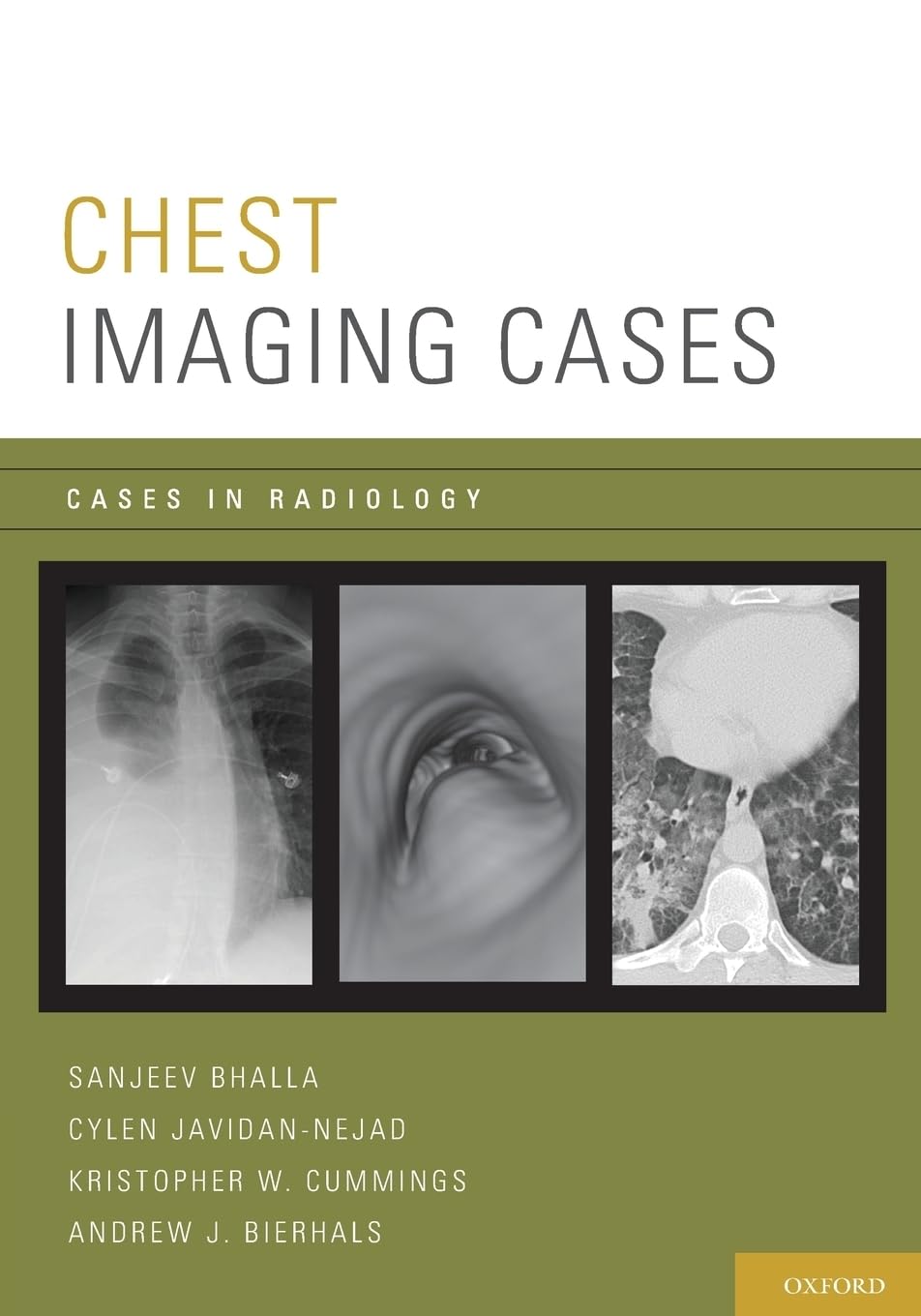 Chest Imaging Cases (Cases in Radiology) by Bhalla, Sanjeev