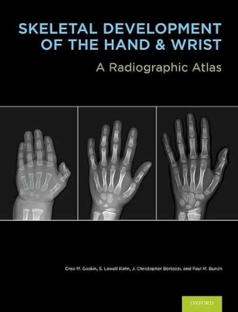 Skeletal Development of the Hand and Wrist: A Radiographic Atlas and Digital Bone Age Companion