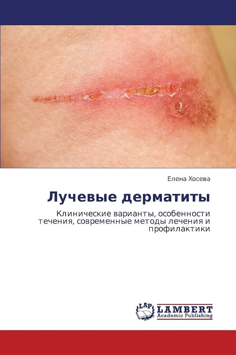 Luchevye dermatity: Klinicheskie varianty, osobennosti techeniya, sovremennye metody lecheniya i profilaktiki (Russian Edition)