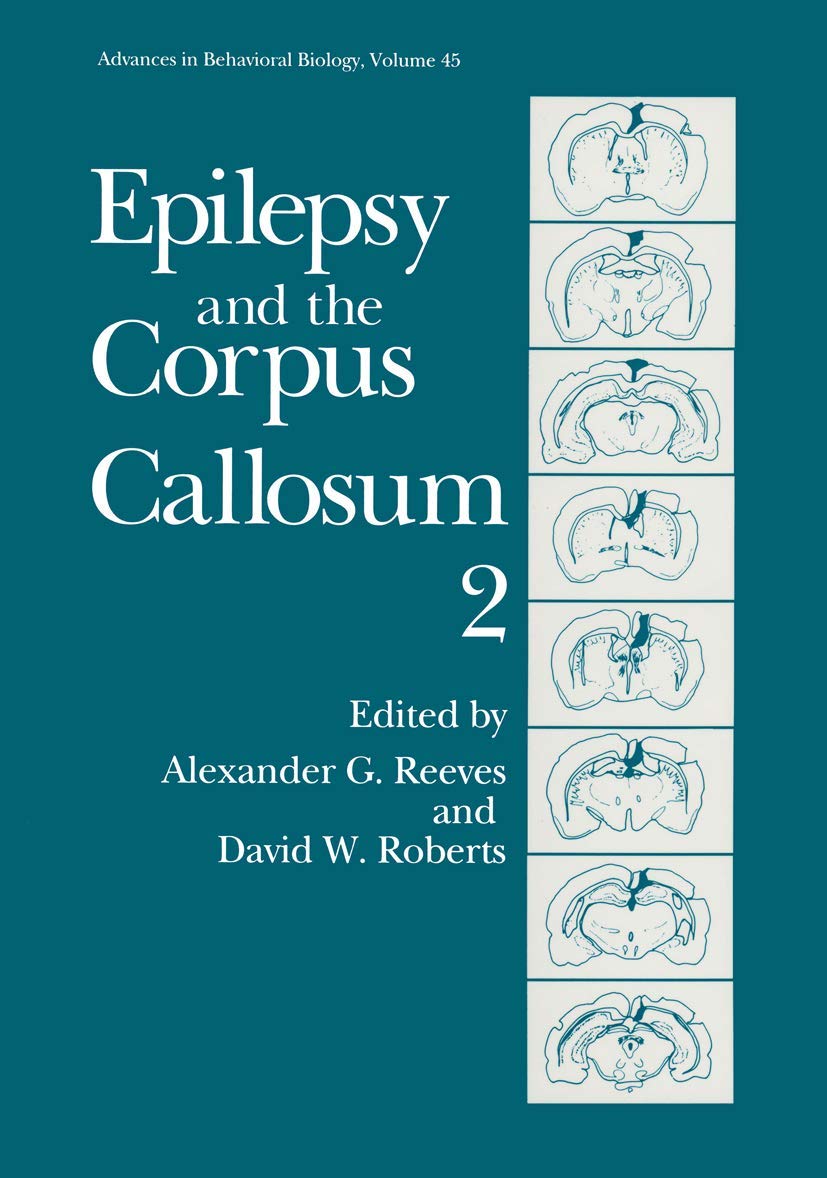 Epilepsy & the Corpus Callosum II