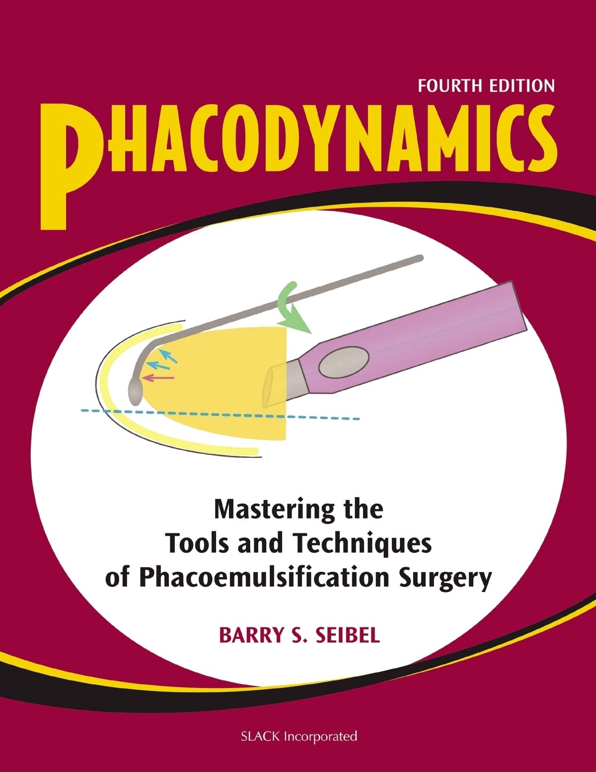 Phacodynamics: Mastering the Tools and Techniques of Phacoemulsification Surgery