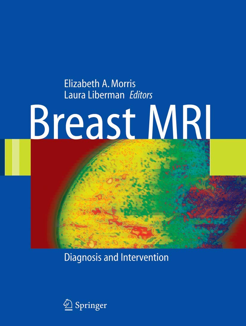 Breast MRI: Diagnosis and Intervention by Liberman, Laura