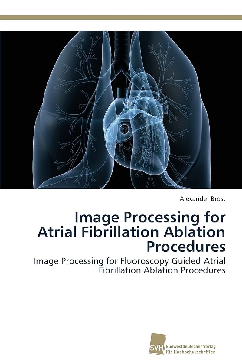 Image Processing for Atrial Fibrillation Ablation Procedures: Image Processing for Fluoroscopy Guided Atrial Fibrillation Ablation Procedures