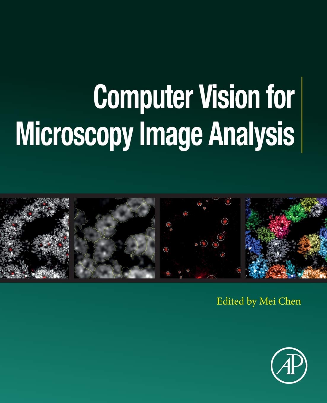Computer Vision for Microscopy Image Analysis (Computer Vision and Pattern Recognition)