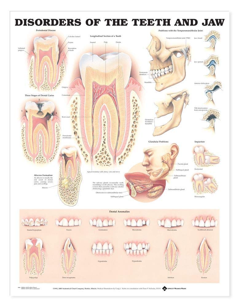 Disorders of the Teeth and Jaw Anatomical Chart by Anatomica