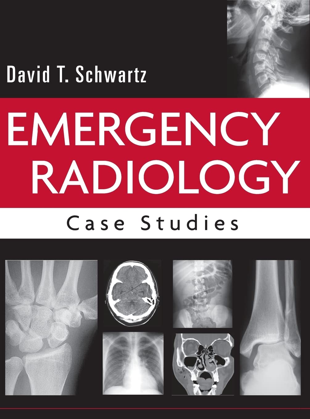 Emergency Radiology: Case Studies