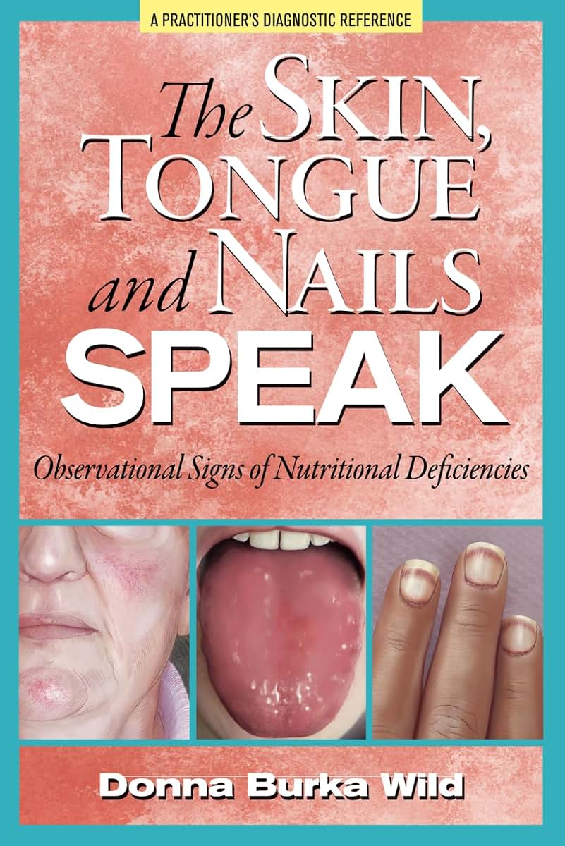 The Skin, Tongue and Nails Speak: Observational Signs of Nutritional Deficiencies
