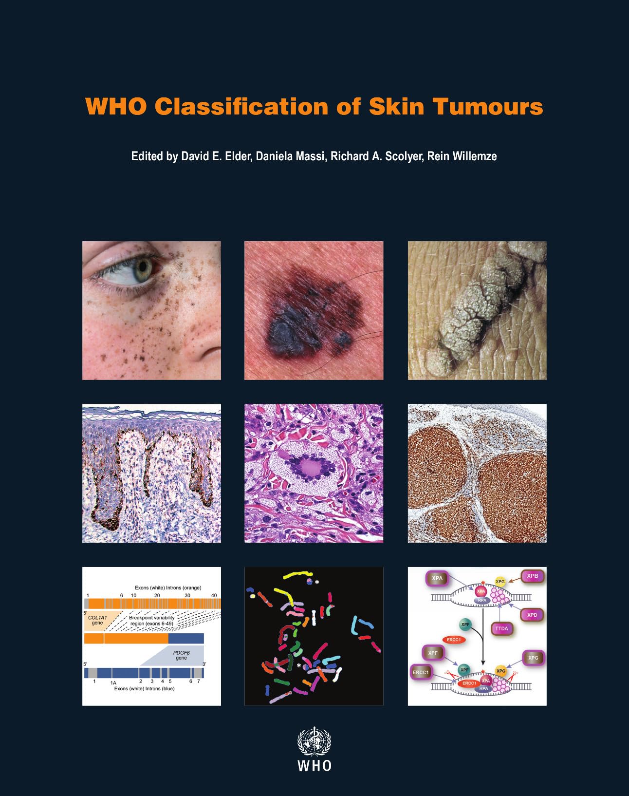 WHO Classification of Skin Tumours (WHO Classification of Tumours)