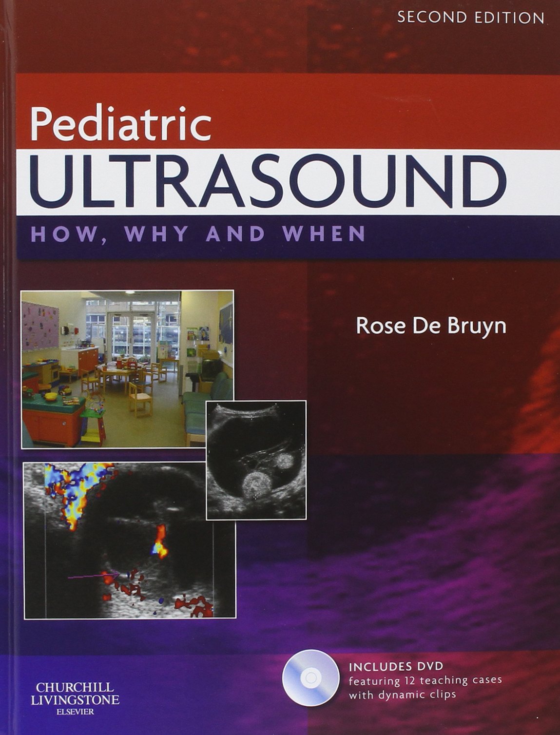 Pediatric Ultrasound: How, Why and When by de Bruyn MBBCh DM