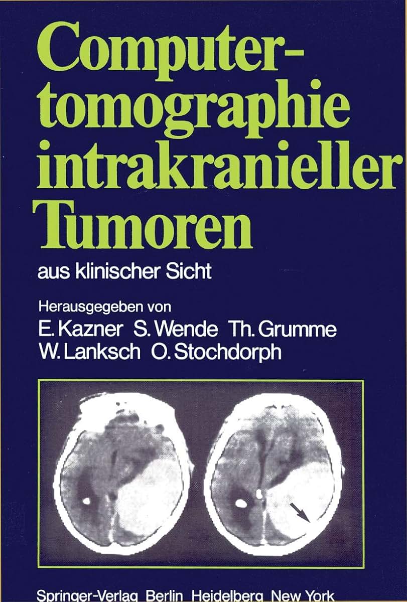 Computertomographie intrakranieller Tumoren aus klinischer Sicht (German Edition)
