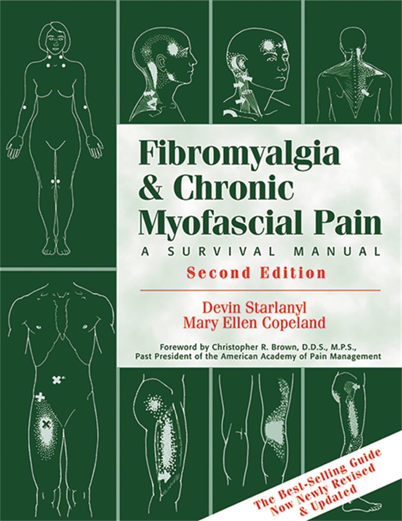 Fibromyalgia and Chronic Myofascial Pain: A Survival Manual (2nd Edition)