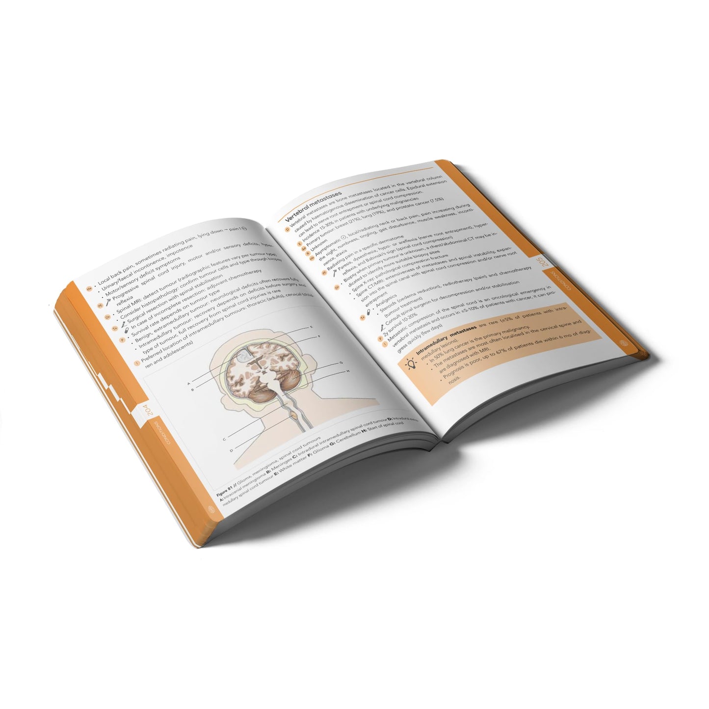 Pocket Neurology