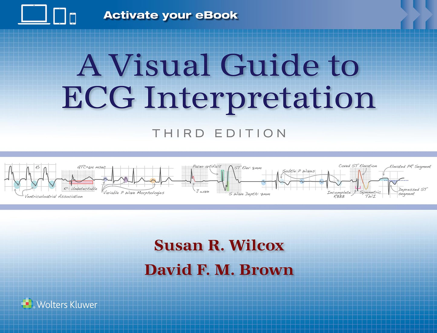 A Visual Guide to ECG Interpretation: Print eBook with Multimedia
