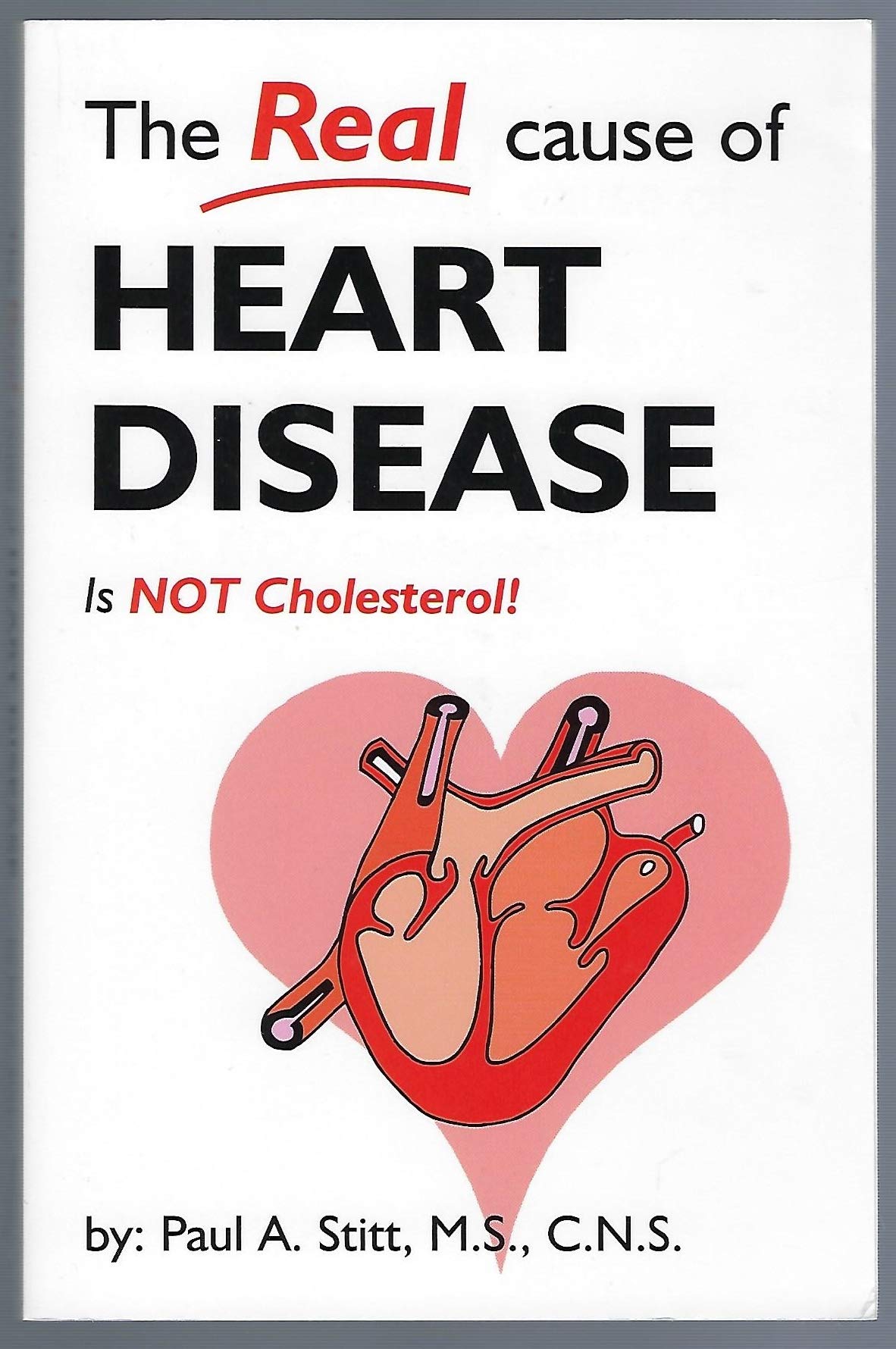 The Real Cause of Heart Disease Is Not Cholesterol by Paul A