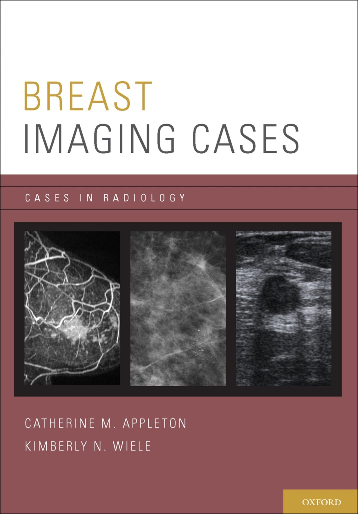 Breast Imaging Cases (Cases in Radiology)