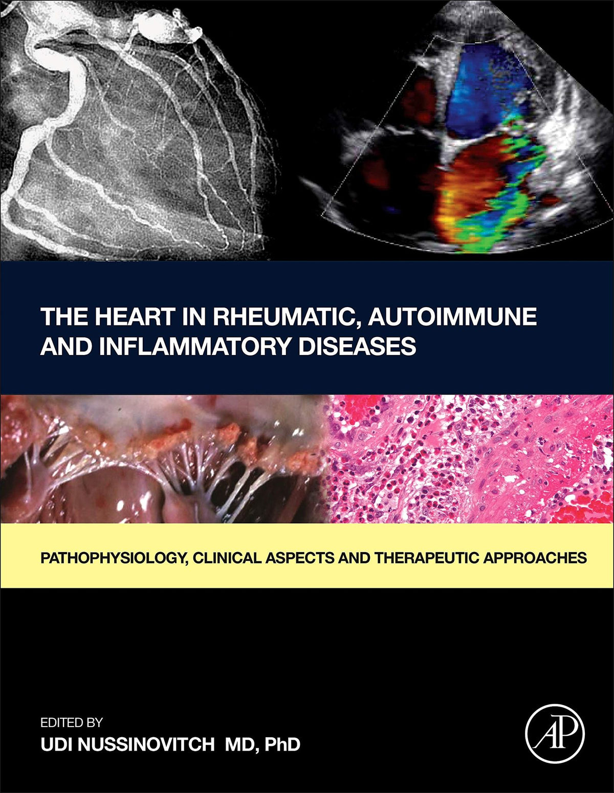 The Heart in Rheumatic, Autoimmune and Inflammatory Diseases: Pathophysiology, Clinical Aspects and Therapeutic Approaches