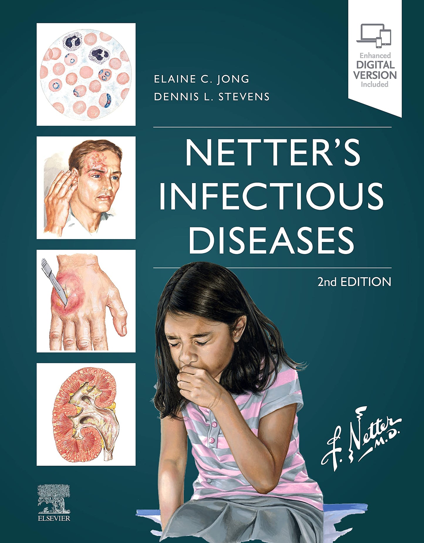 Netter's Infectious Diseases by Jong MD FIDSA FASTMH, Elaine