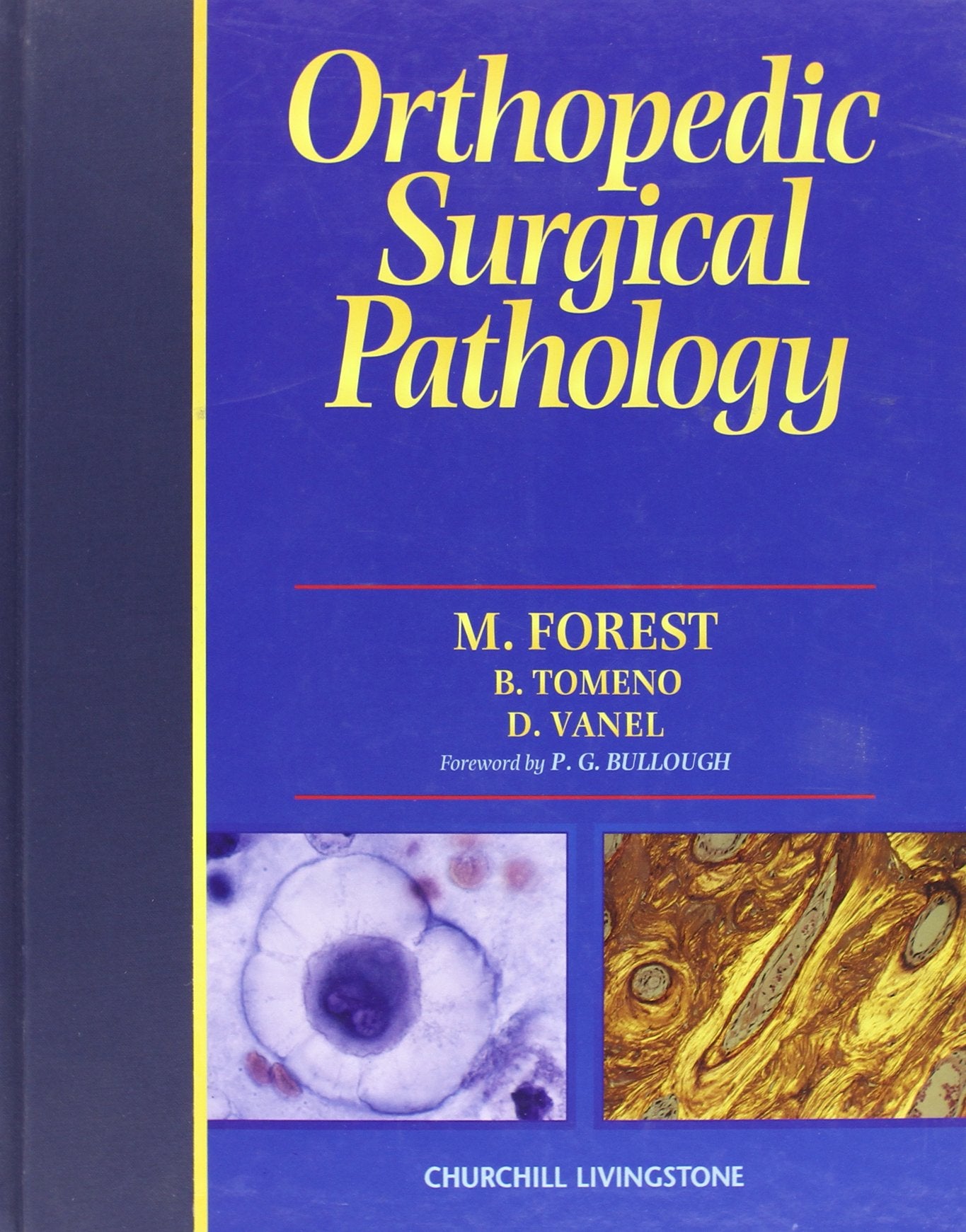Orthopedic Surgical Pathology: Diagnosis of Tumors and Pseudotumoral Lesions of Bone and Joints