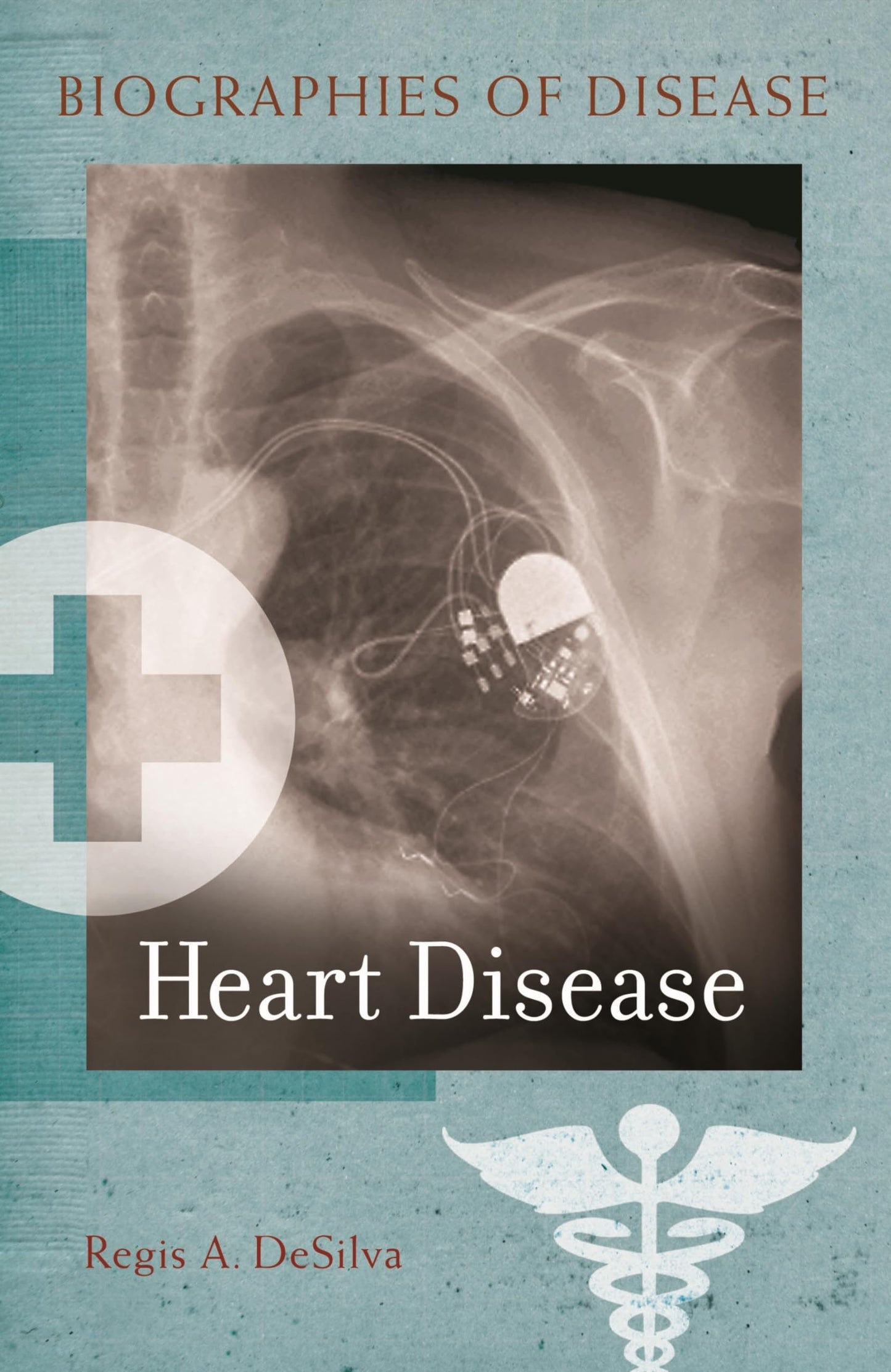 Heart Disease (Biographies of Disease)