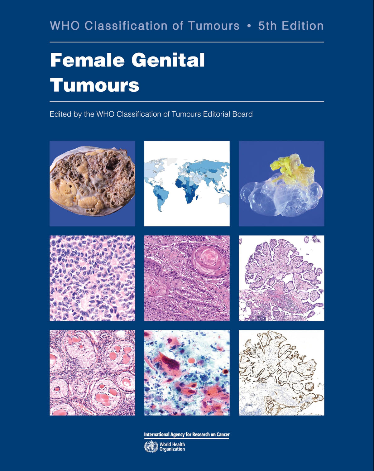 Female Genital Tumours: WHO Classification of Tumours (Medicine)