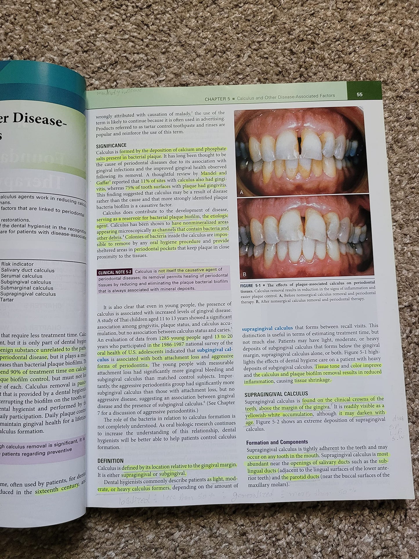 Periodontology for the Dental Hygienist (Perry, Periodontology for the Dental Hygienist)