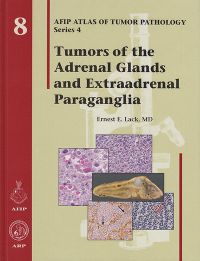 Tumors of the Adrenal Glands and Extraadrenal Paraganglia - Volume 8 (Afip Atlas of Tumor Pathology Series 4)