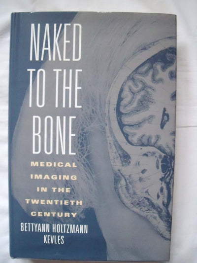 Naked to the Bone: Medical Imaging in the Twentieth Century (Sloan Technology Series)