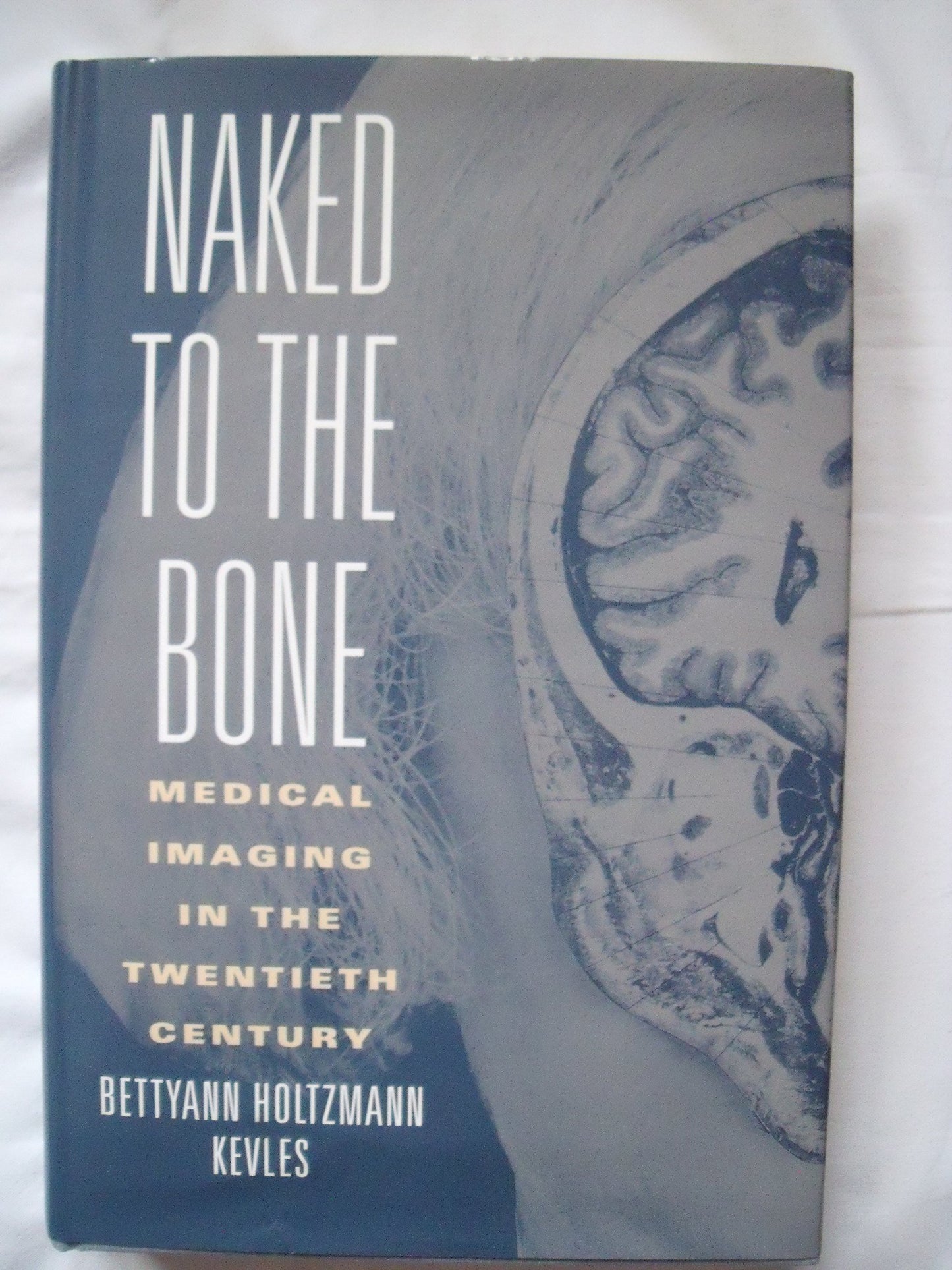Naked to the Bone: Medical Imaging in the Twentieth Century (Sloan Technology Series)