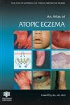 An Atlas of Atopic Eczema (Encyclopedia of Visual Medicine Series, 71)
