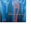Novel Therapeutic Targets for Antiarrhythmic Drugs by Billma