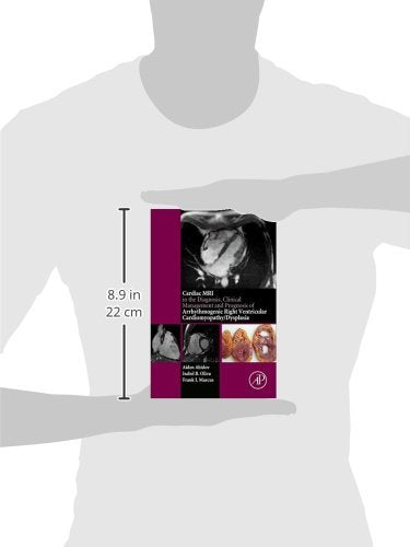 Cardiac MRI in Diagnosis, Clinical Management, and Prognosis of Arrhythmogenic Right Ventricular Cardiomyopathy/Dysplasia