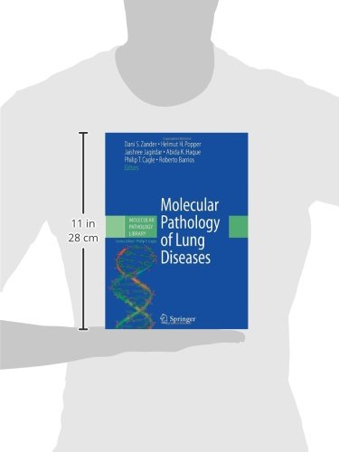 Molecular Pathology of Lung Diseases (Molecular Pathology Library, 1)