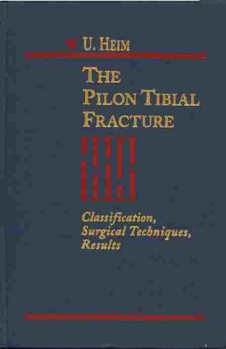 The Pilon Tibial Fracture: Classification, Surgical Techniques, Results